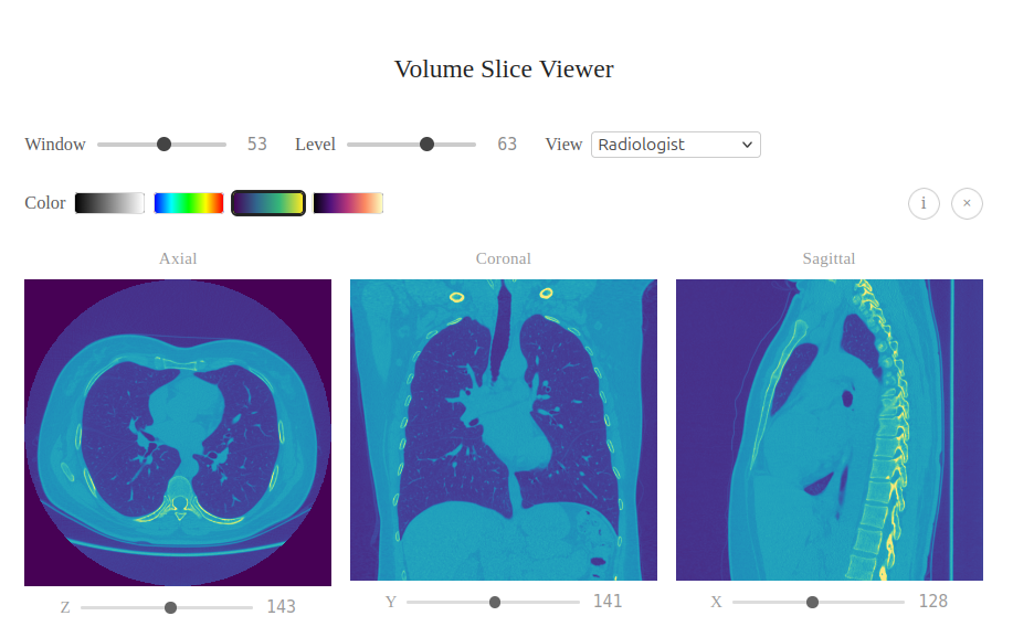 Task 01 — Slice Extraction and Display
