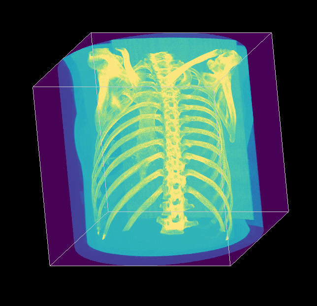 Task 02 — Maximum Intensity Projection
